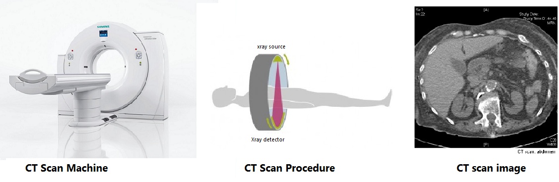 Imaging using X rays